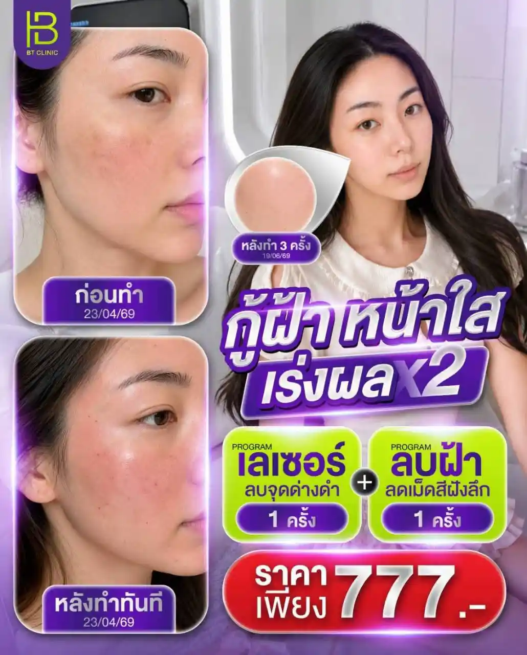 โปรโมชัน 004
