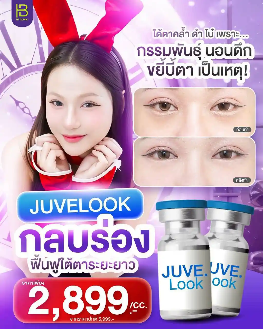 โปรโมชัน 022