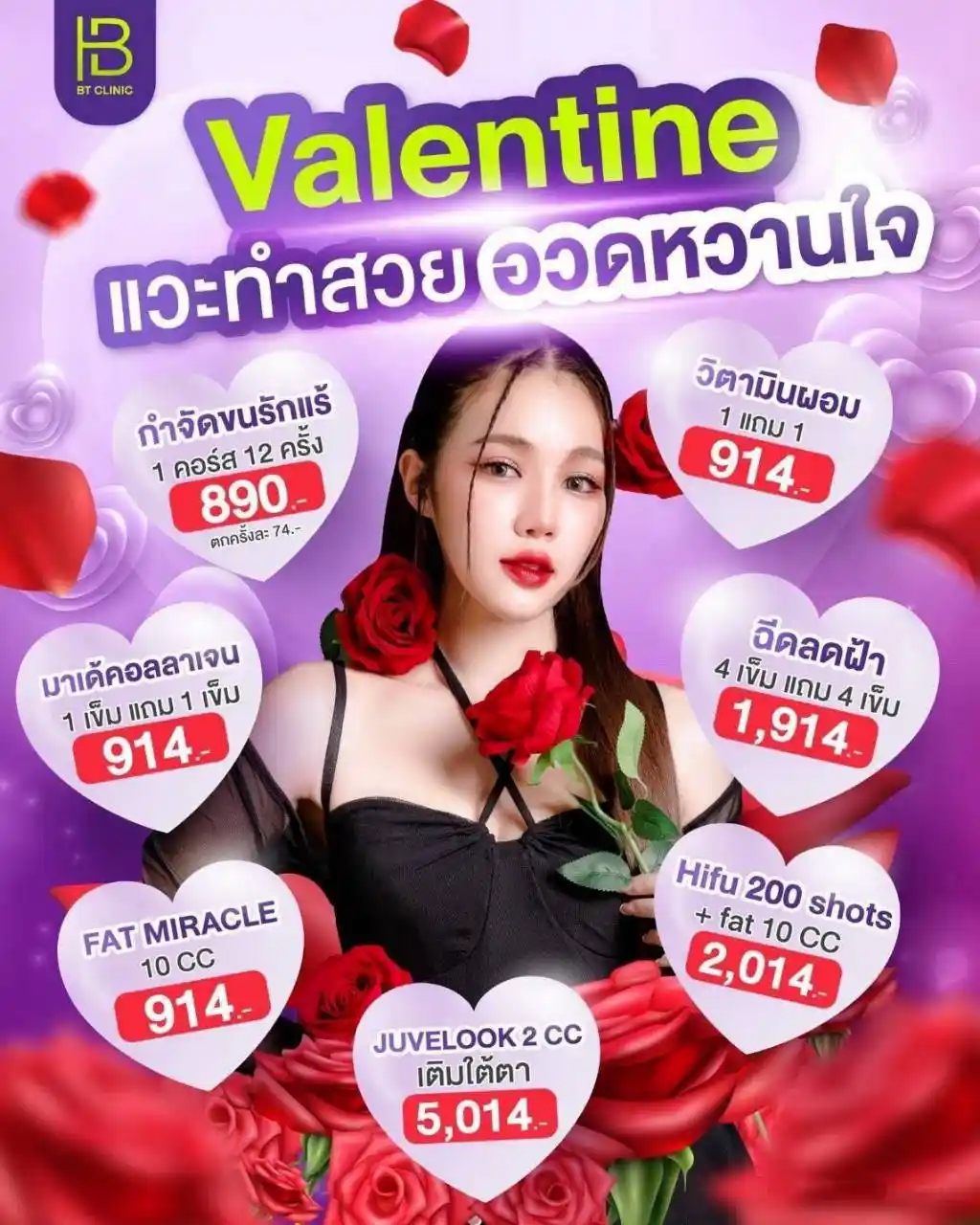 โปรโมชัน 049