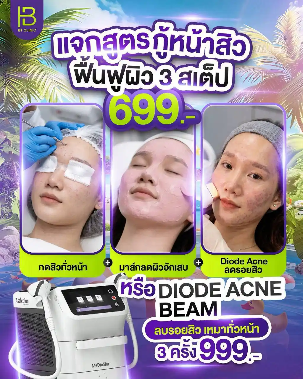 โปรโมชัน 063