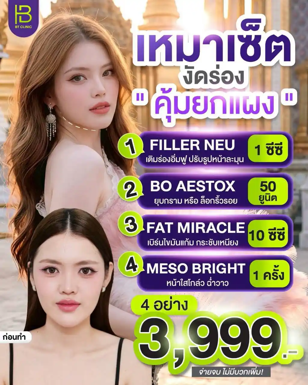 โปรโมชัน 070