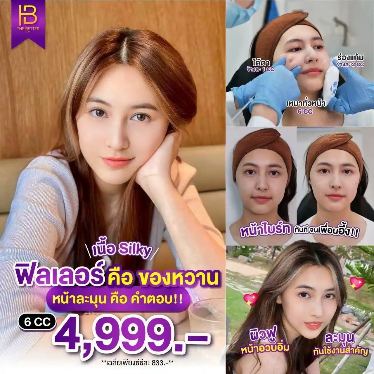 โปรโมชัน 073