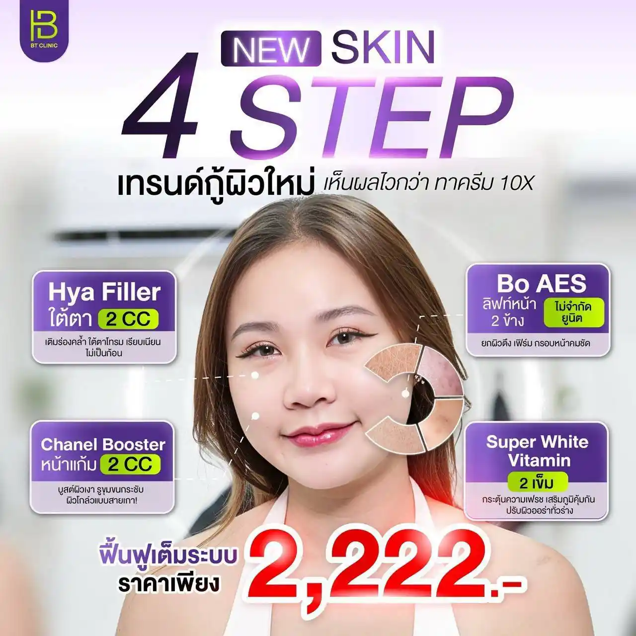 โปรโมชัน 076
