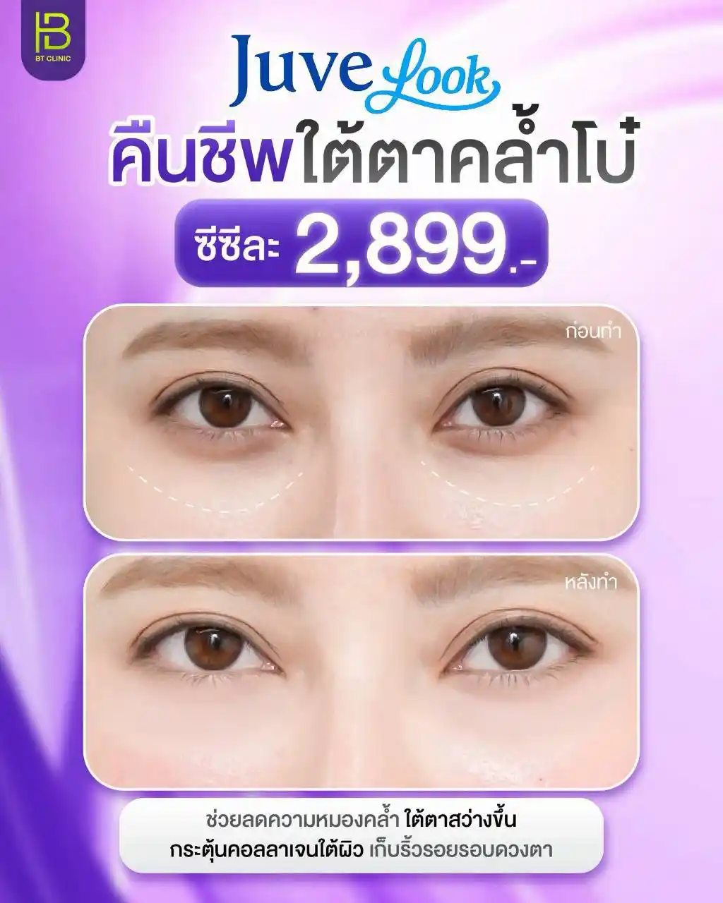 โปรโมชัน 098