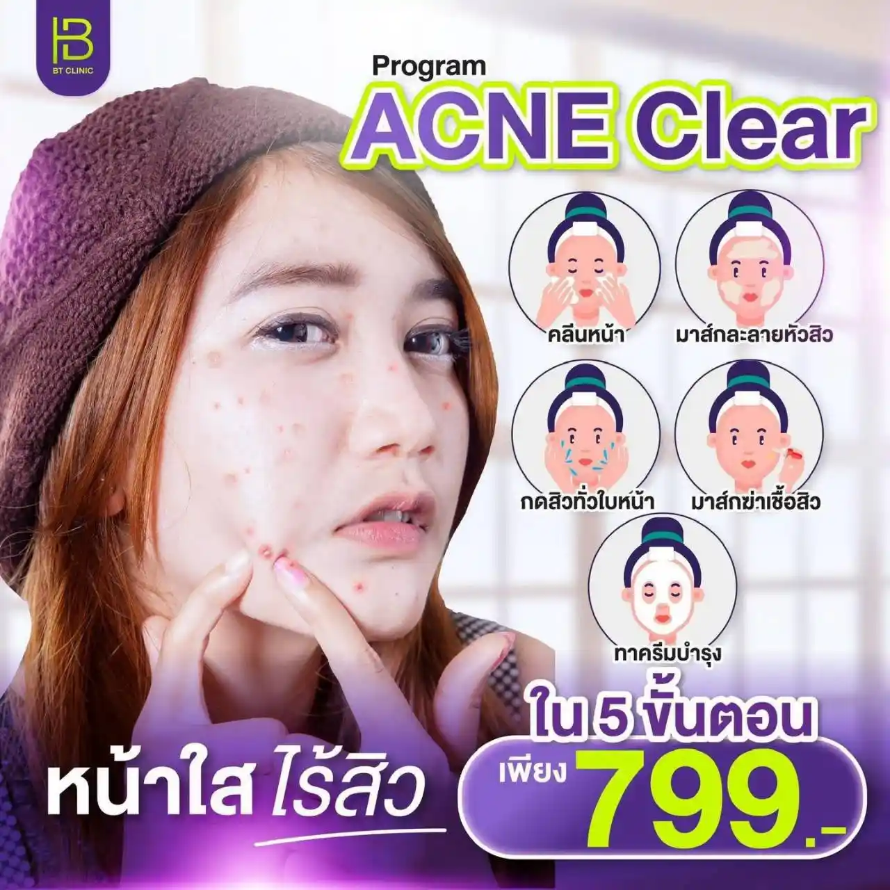 โปรโมชัน 102