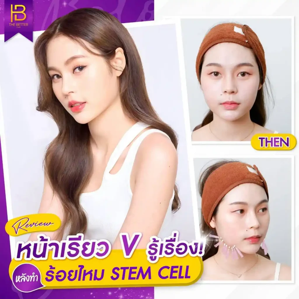 รูปรีวิว 002