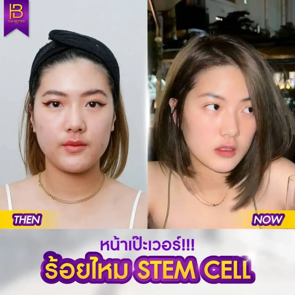 รูปรีวิว 003