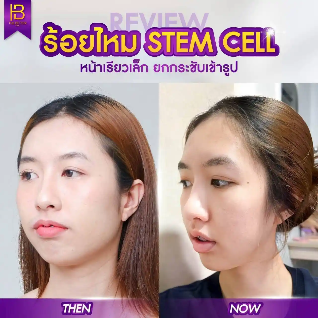 รูปรีวิว 004