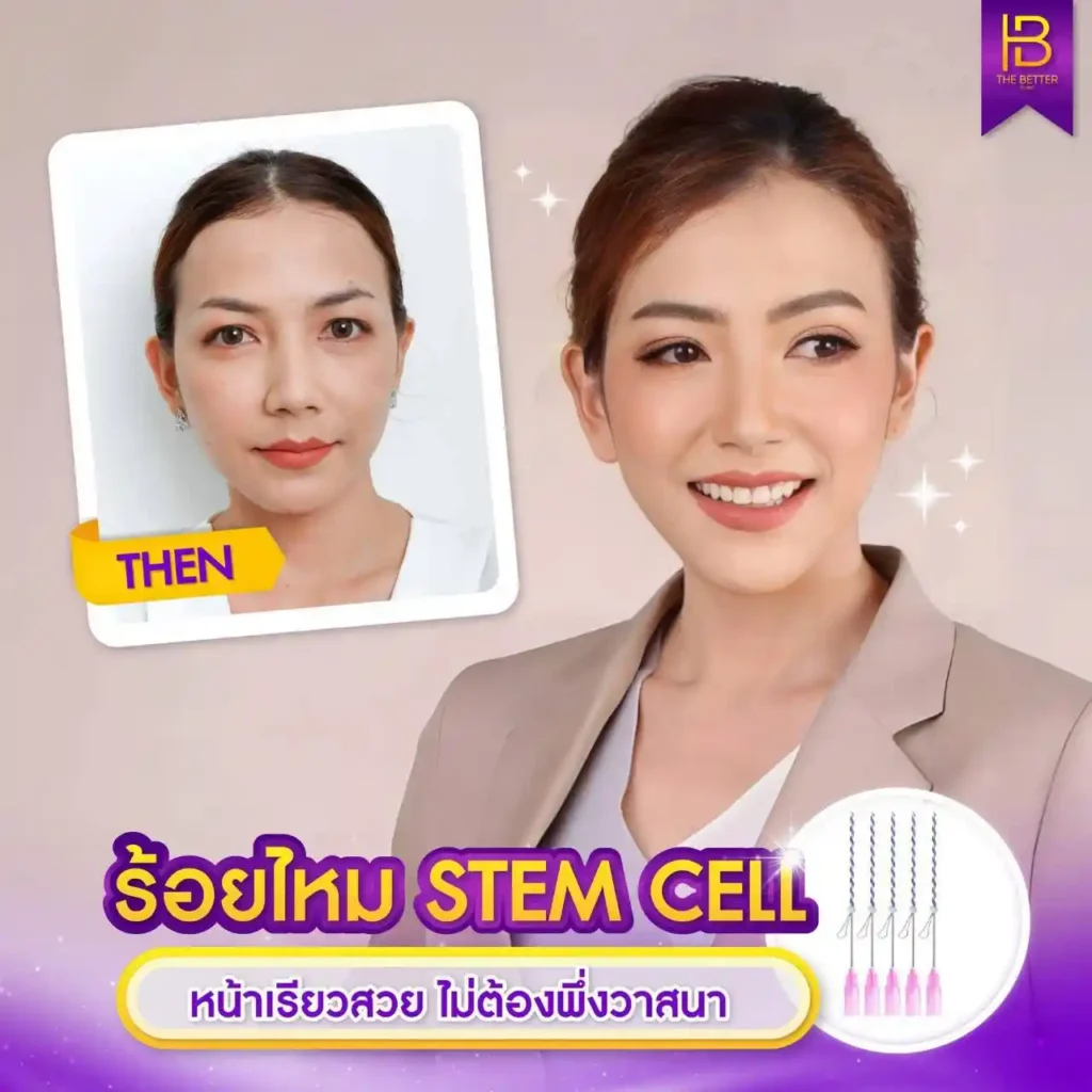 รูปรีวิว 005
