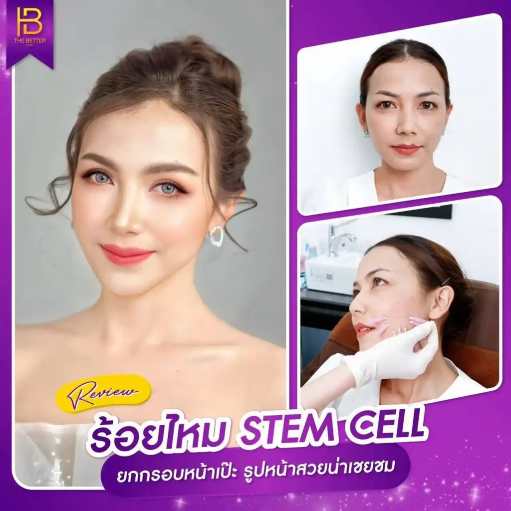รูปรีวิว 009
