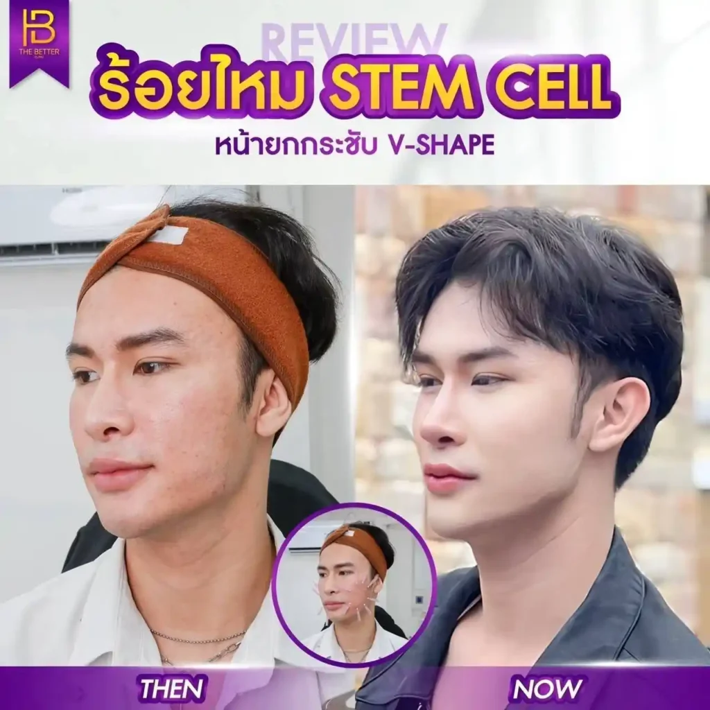 รูปรีวิว 010