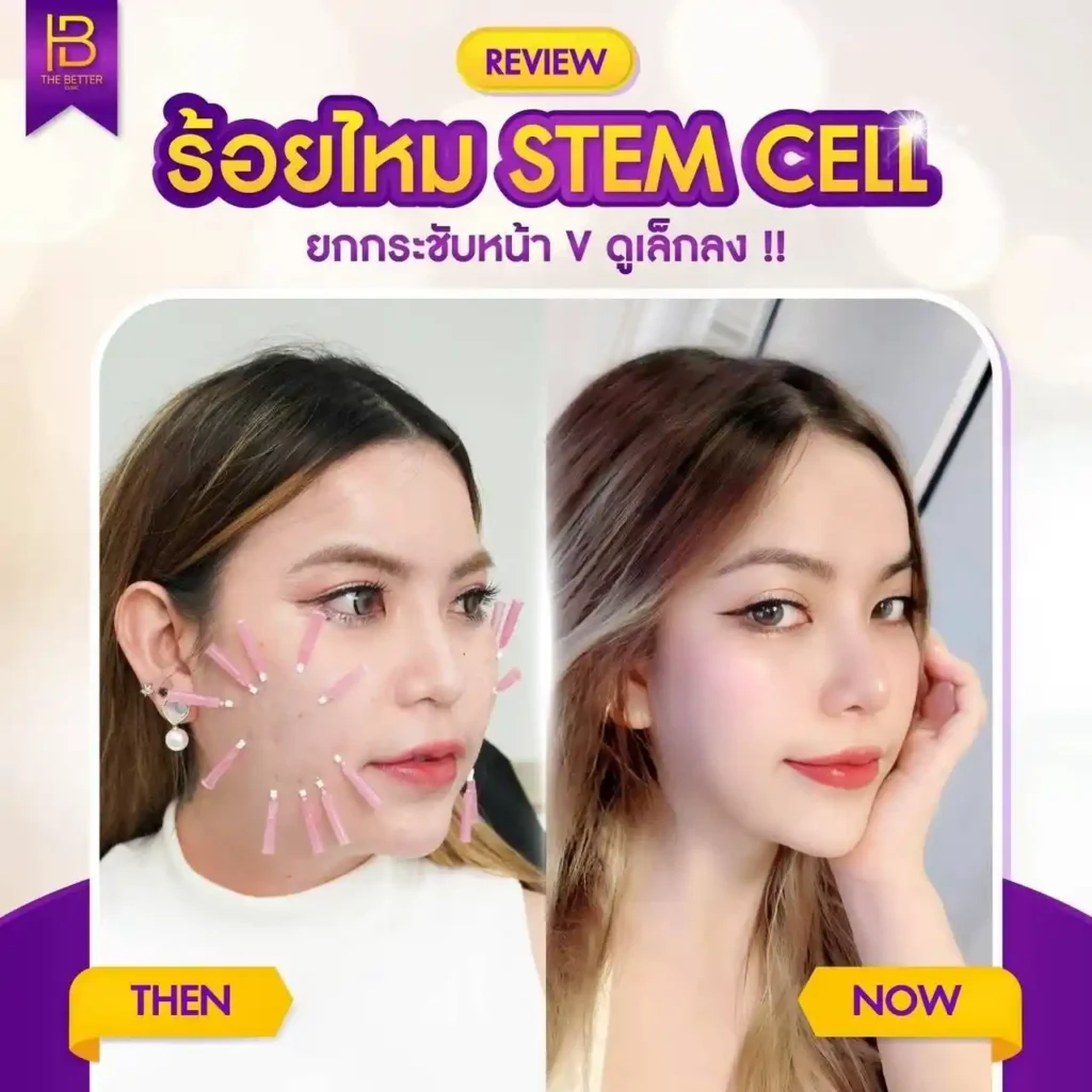 รูปรีวิว 011