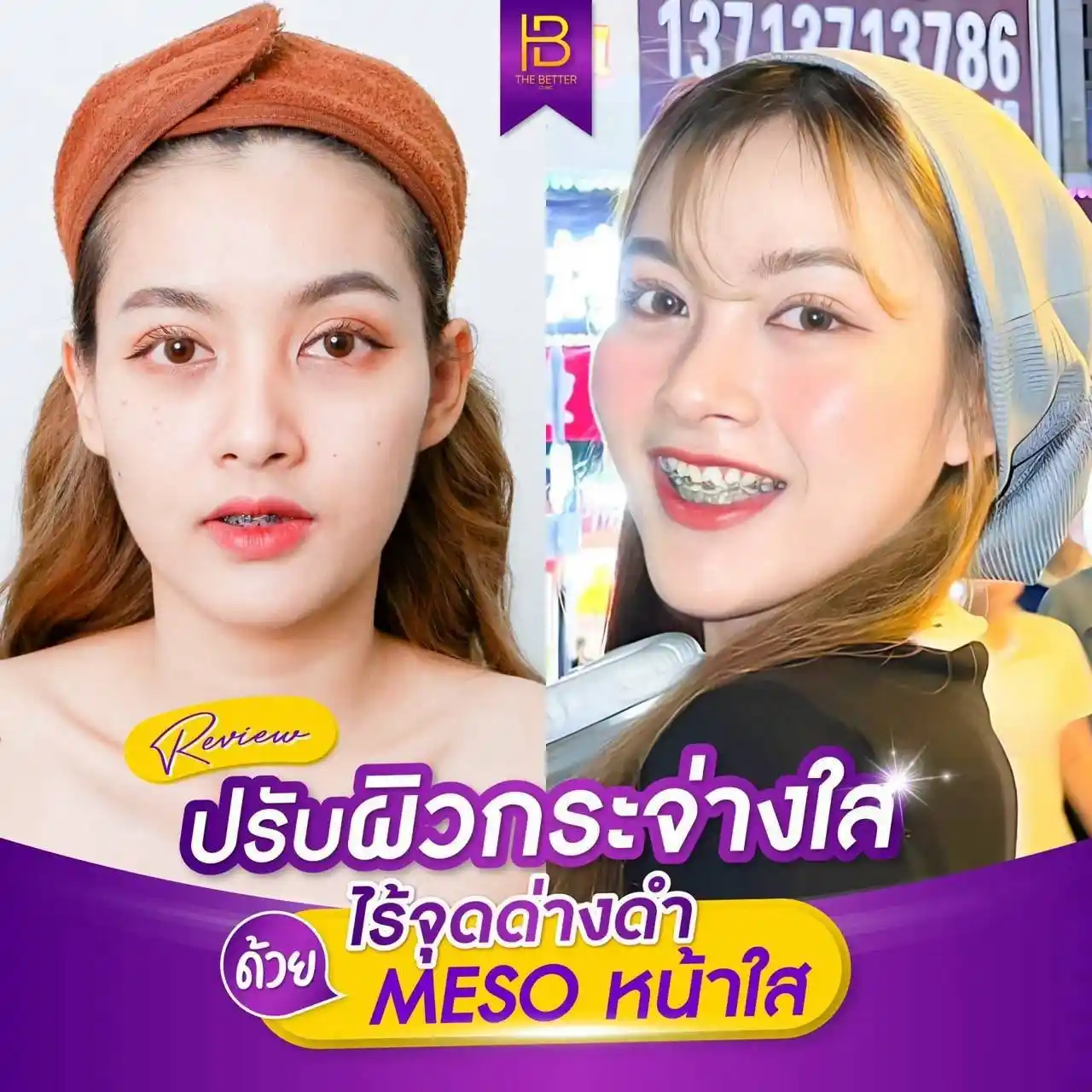 รูปรีวิว 016