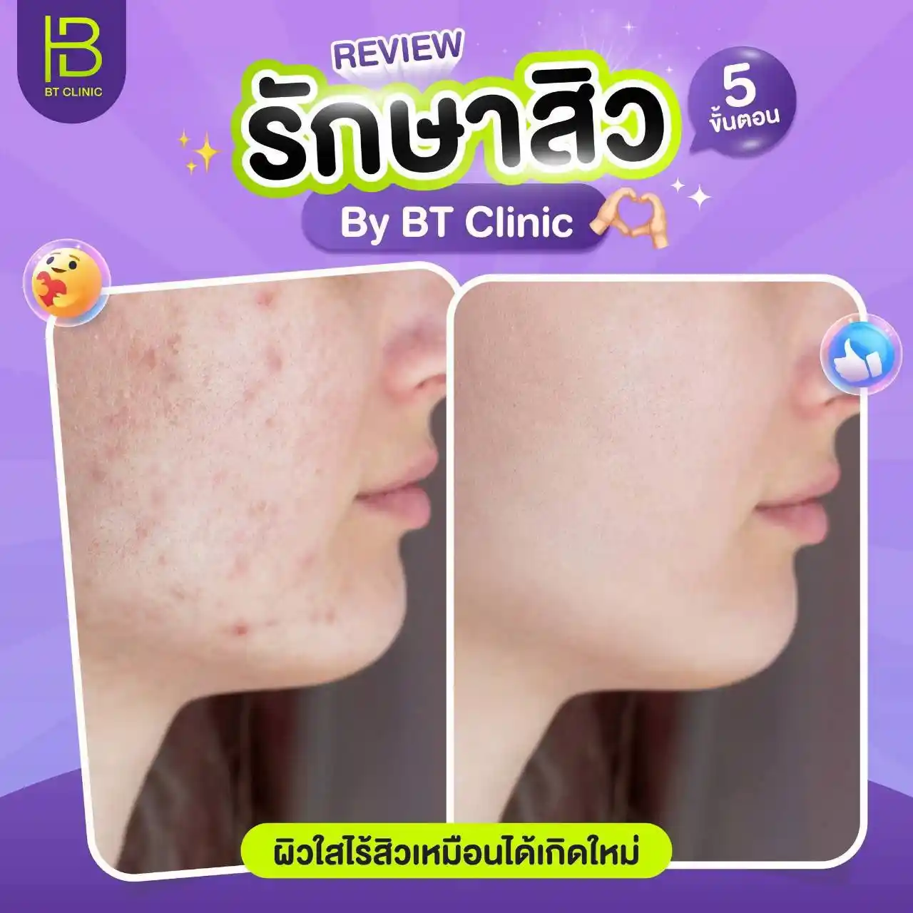 รูปรีวิว 018