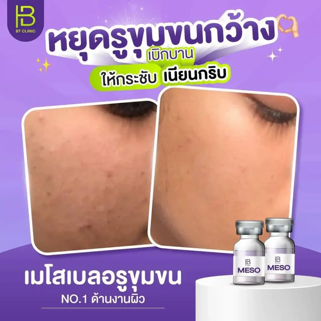 รูปรีวิว 018
