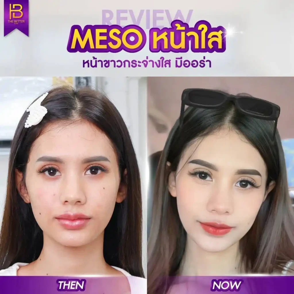 รูปรีวิว 020