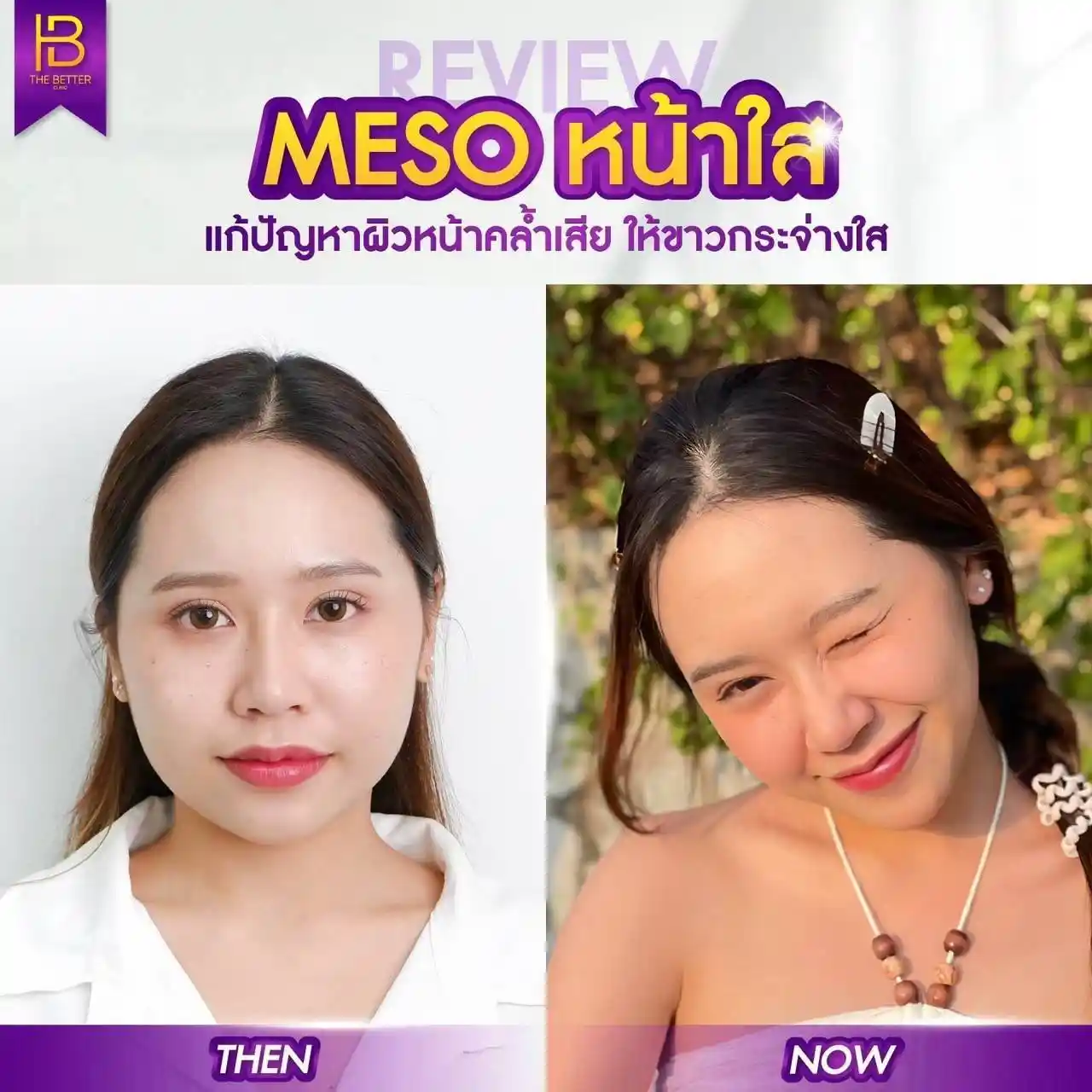 รูปรีวิว 021