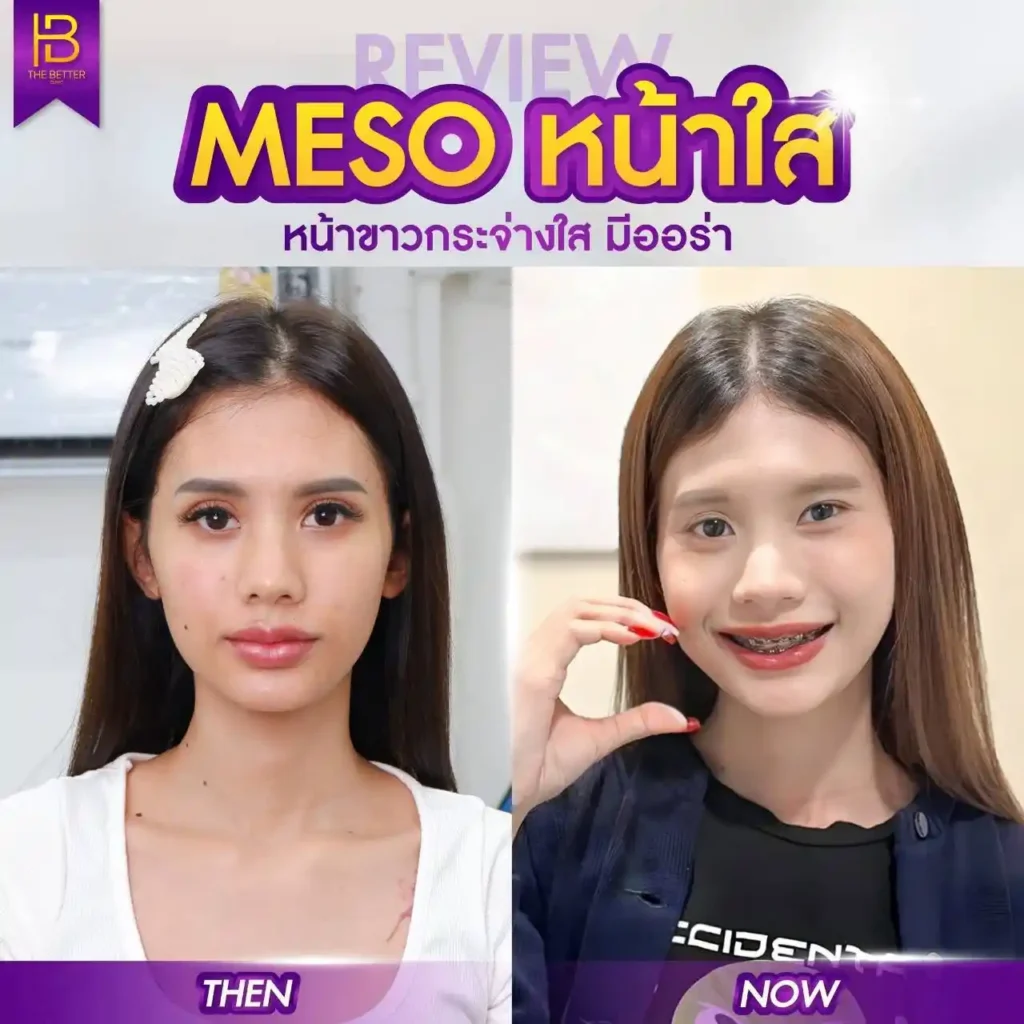 รูปรีวิว 023