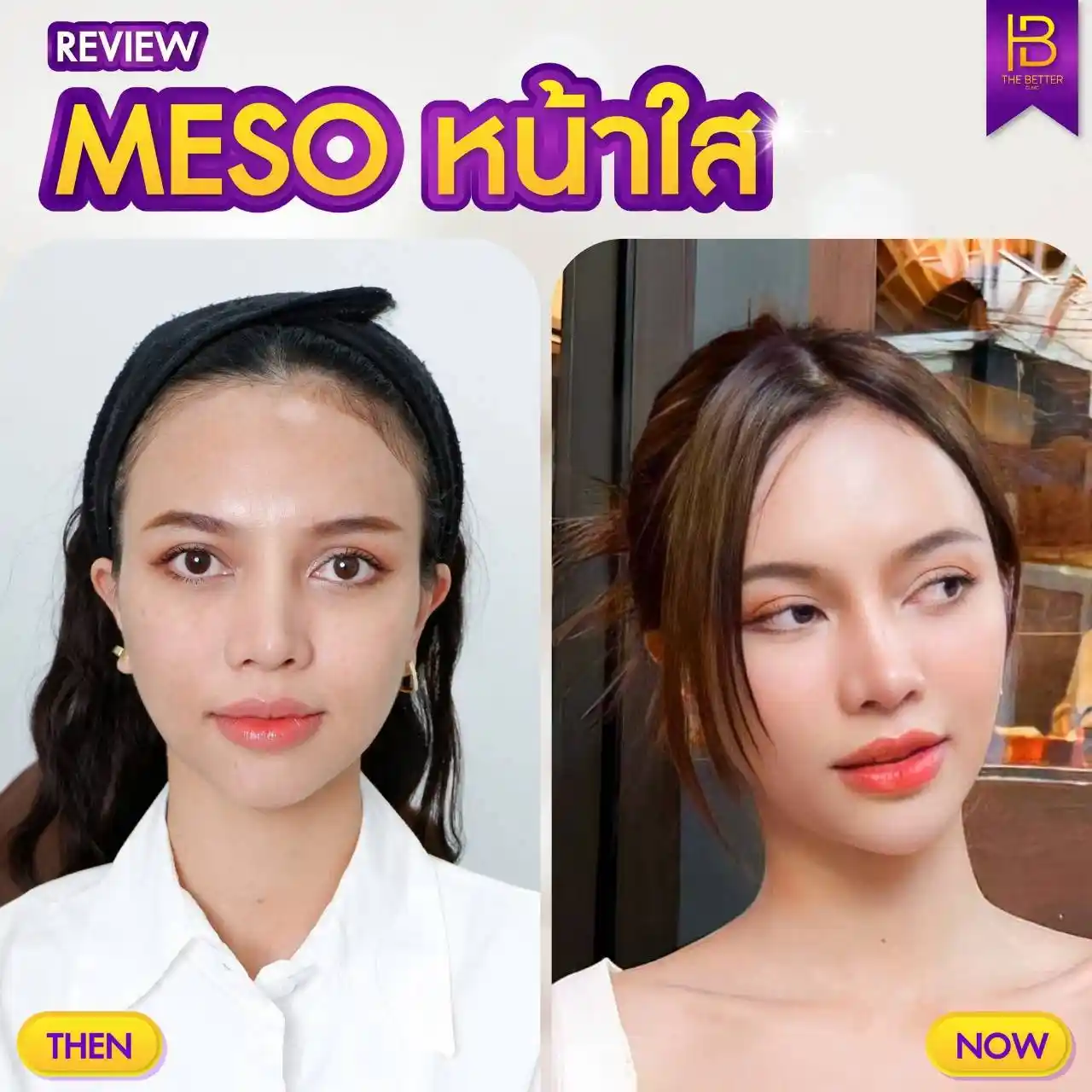 รูปรีวิว 025
