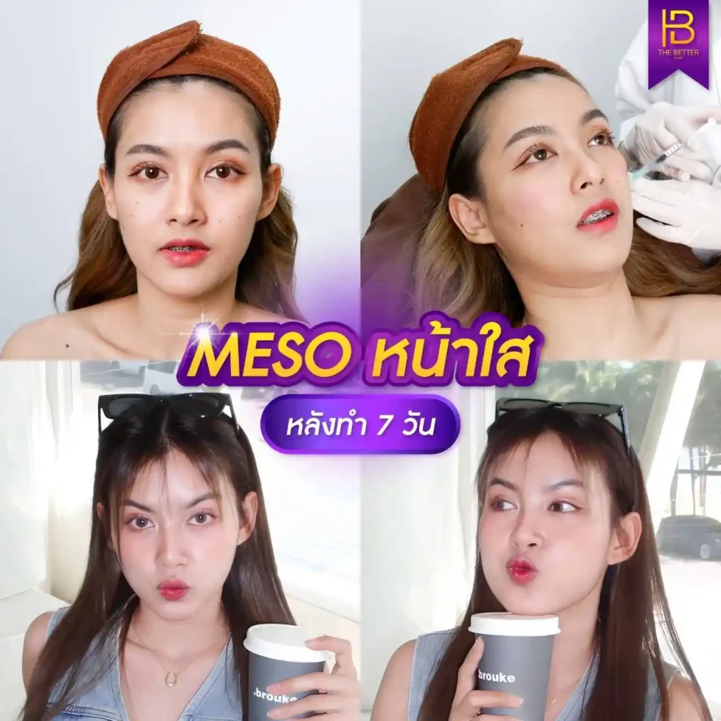 รูปรีวิว 026