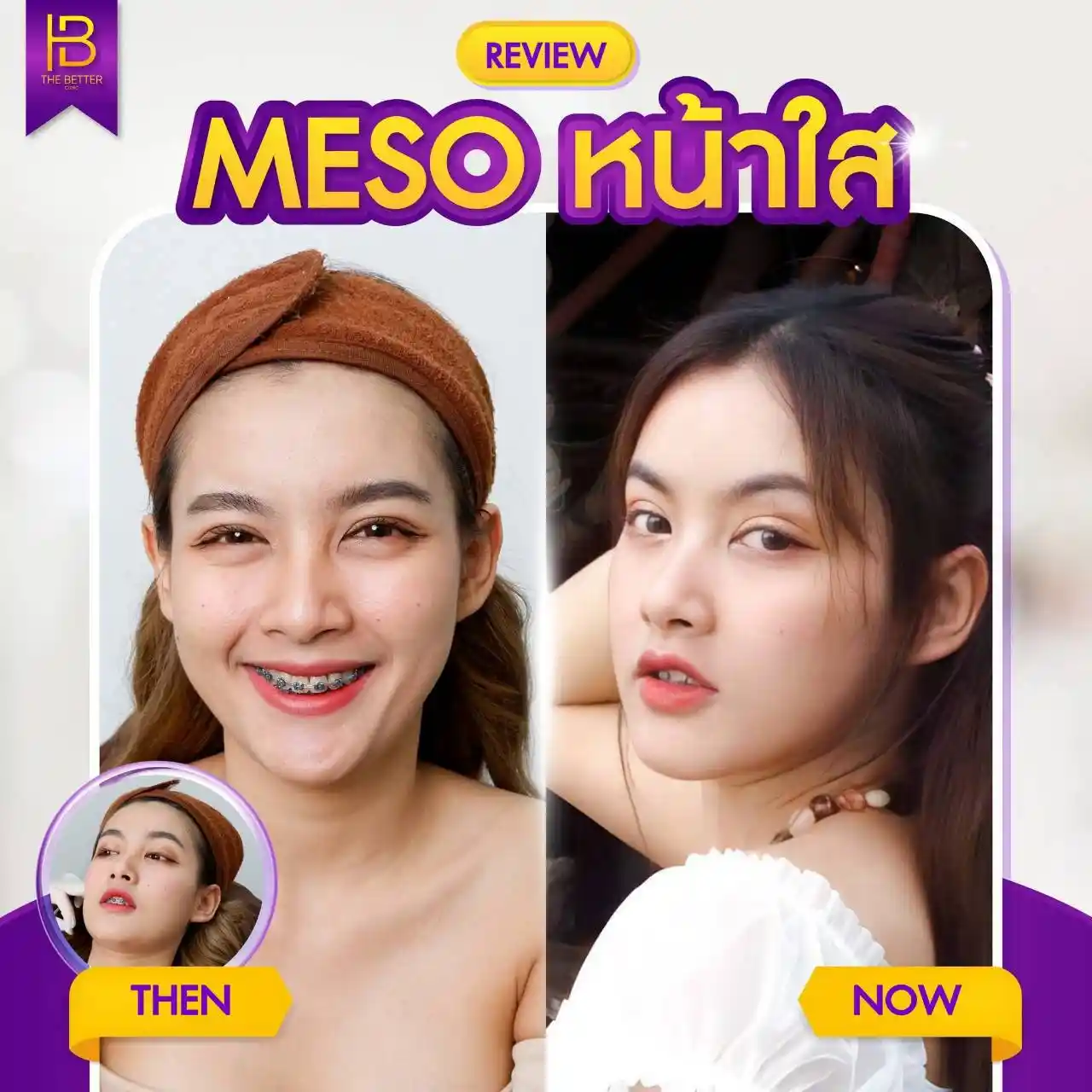 รูปรีวิว 027