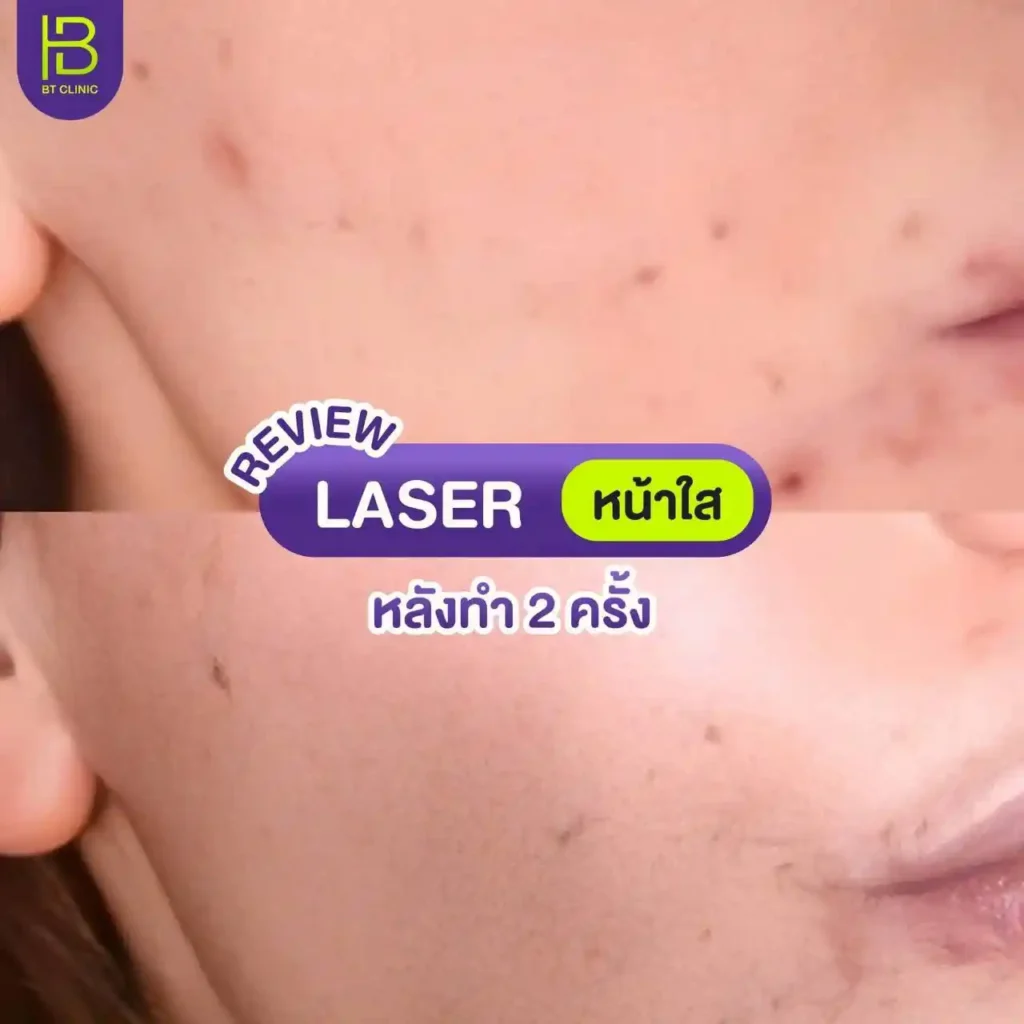 รูปรีวิว 043