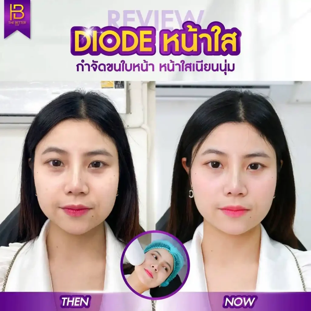 รูปรีวิว 044