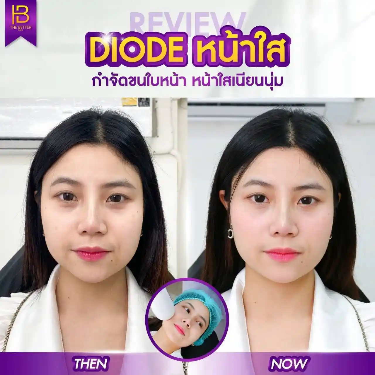 รูปรีวิว 044