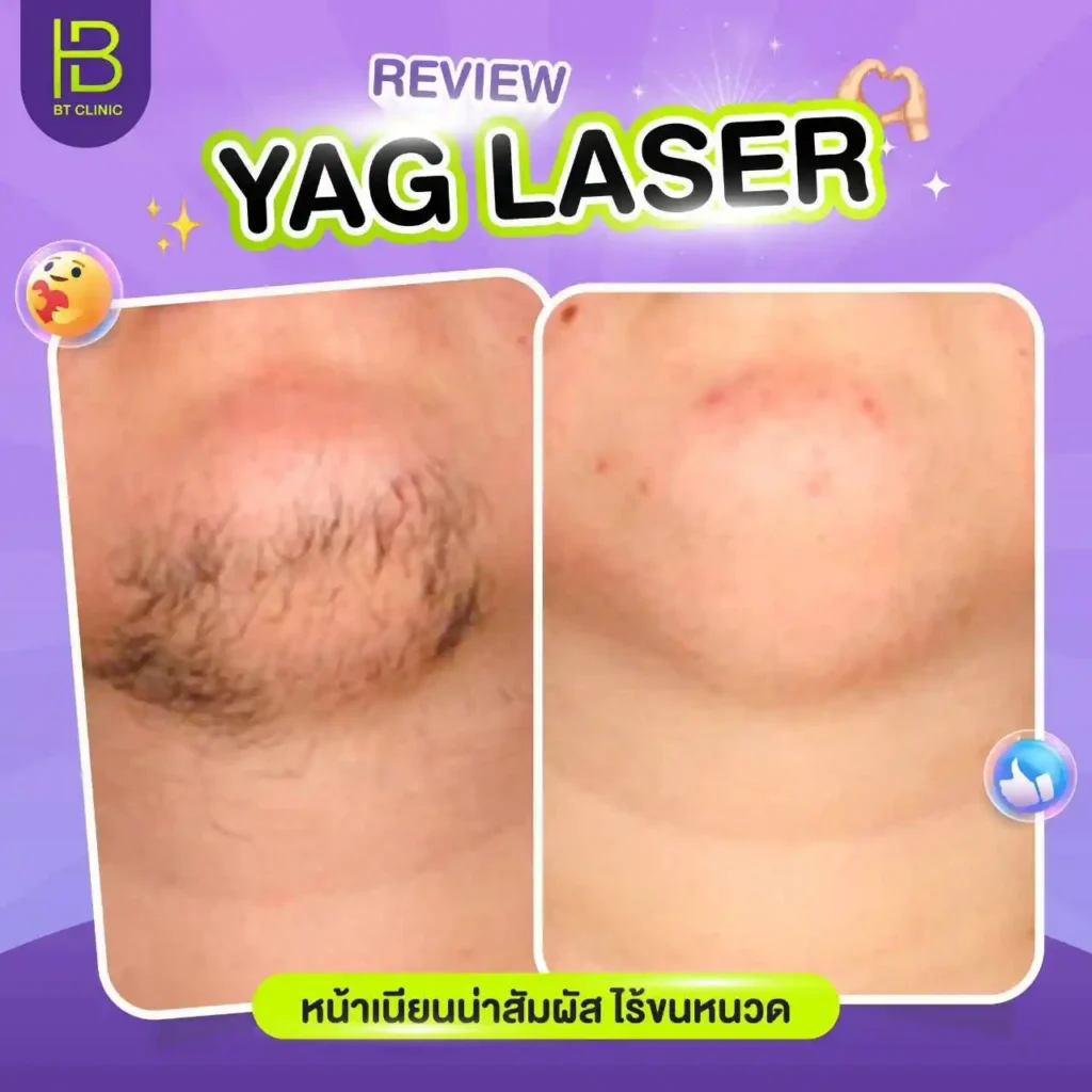 รูปรีวิว 047