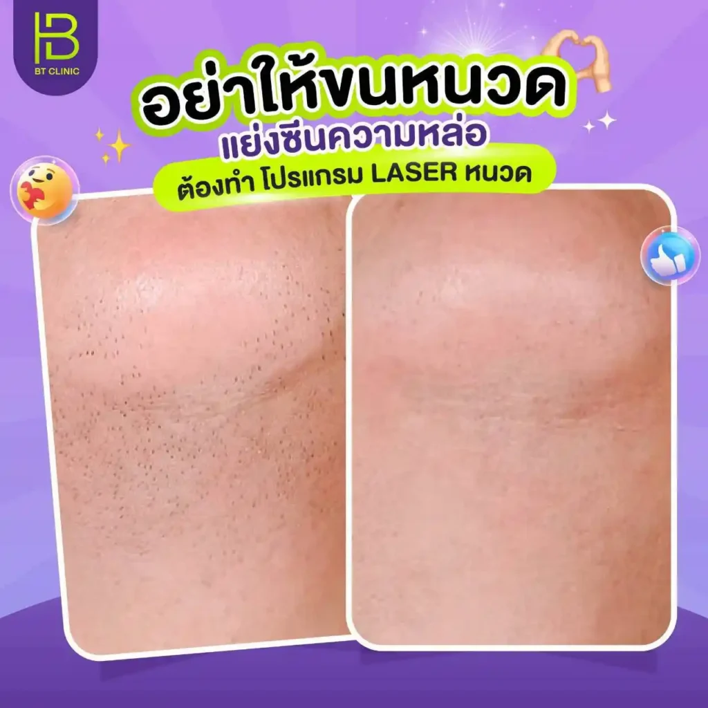 รูปรีวิว 049