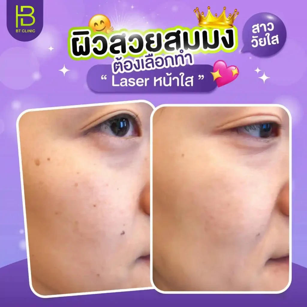 รูปรีวิว 052