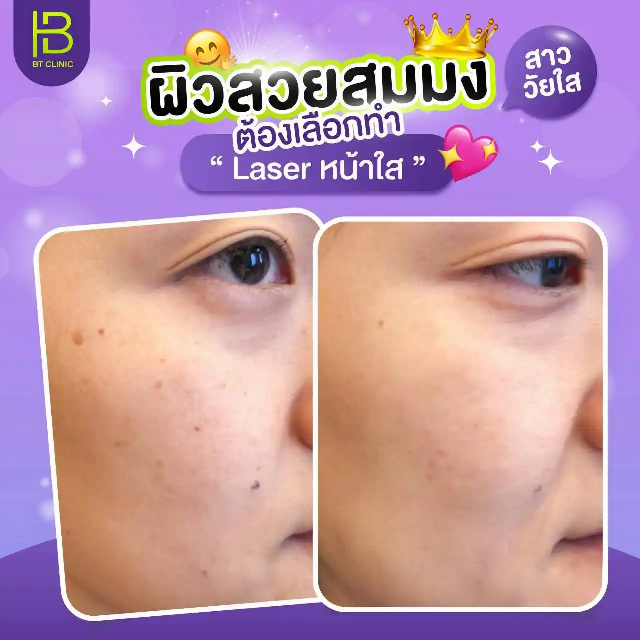 รูปรีวิว 052