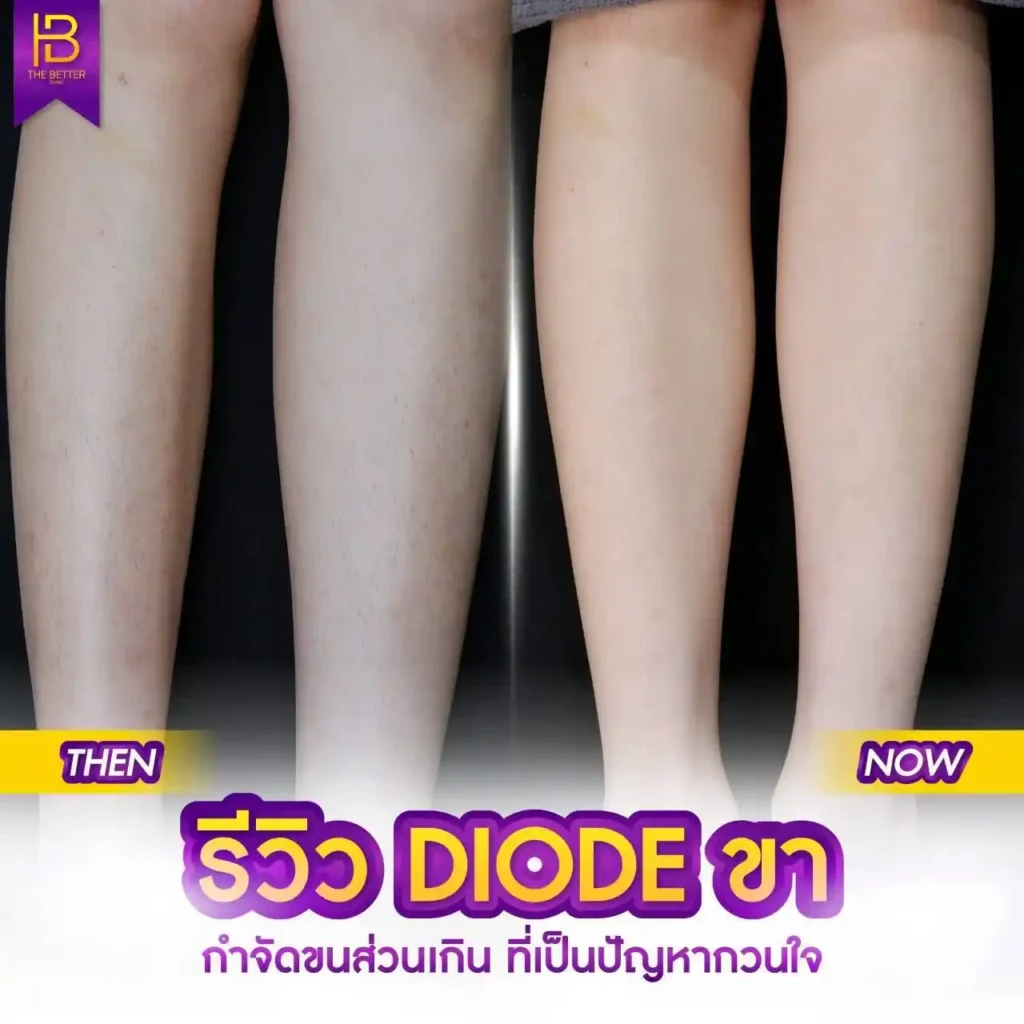รูปรีวิว 053