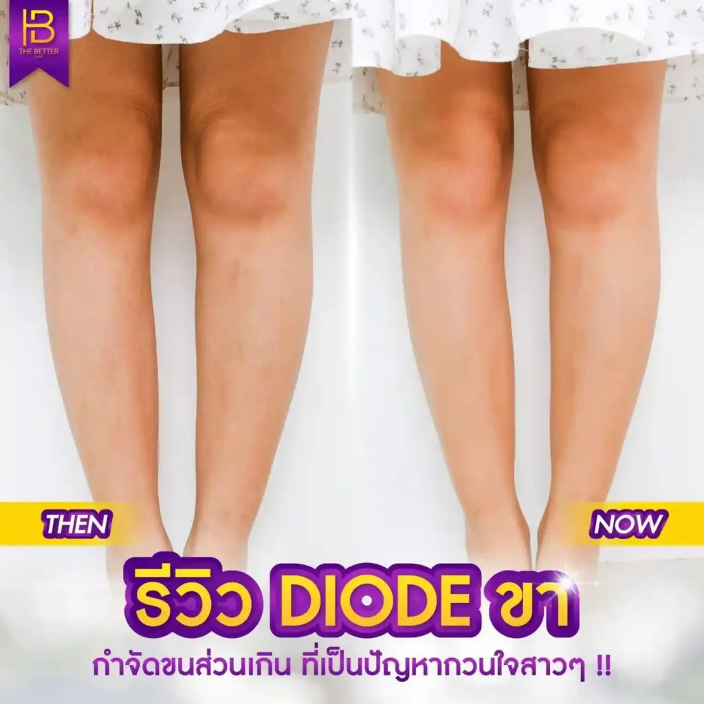 รูปรีวิว 055