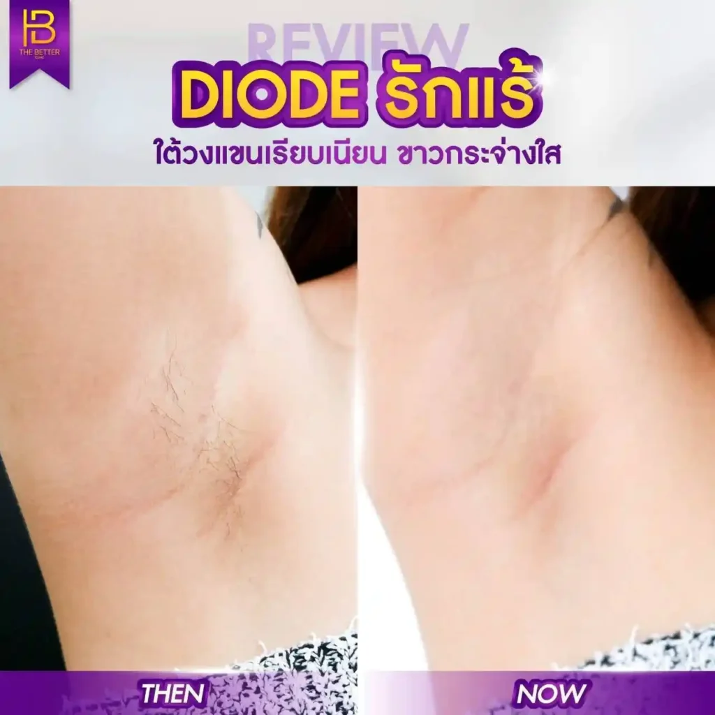 รูปรีวิว 056