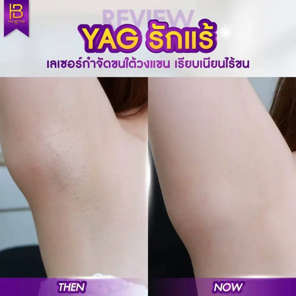 รูปรีวิว 058