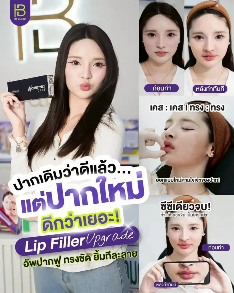 รูปรีวิว 064