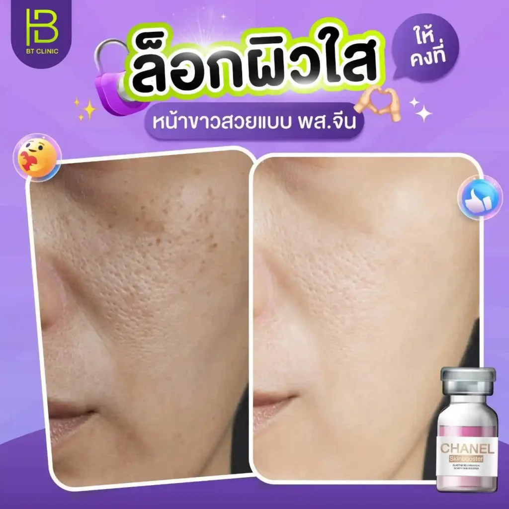 รูปรีวิว 075