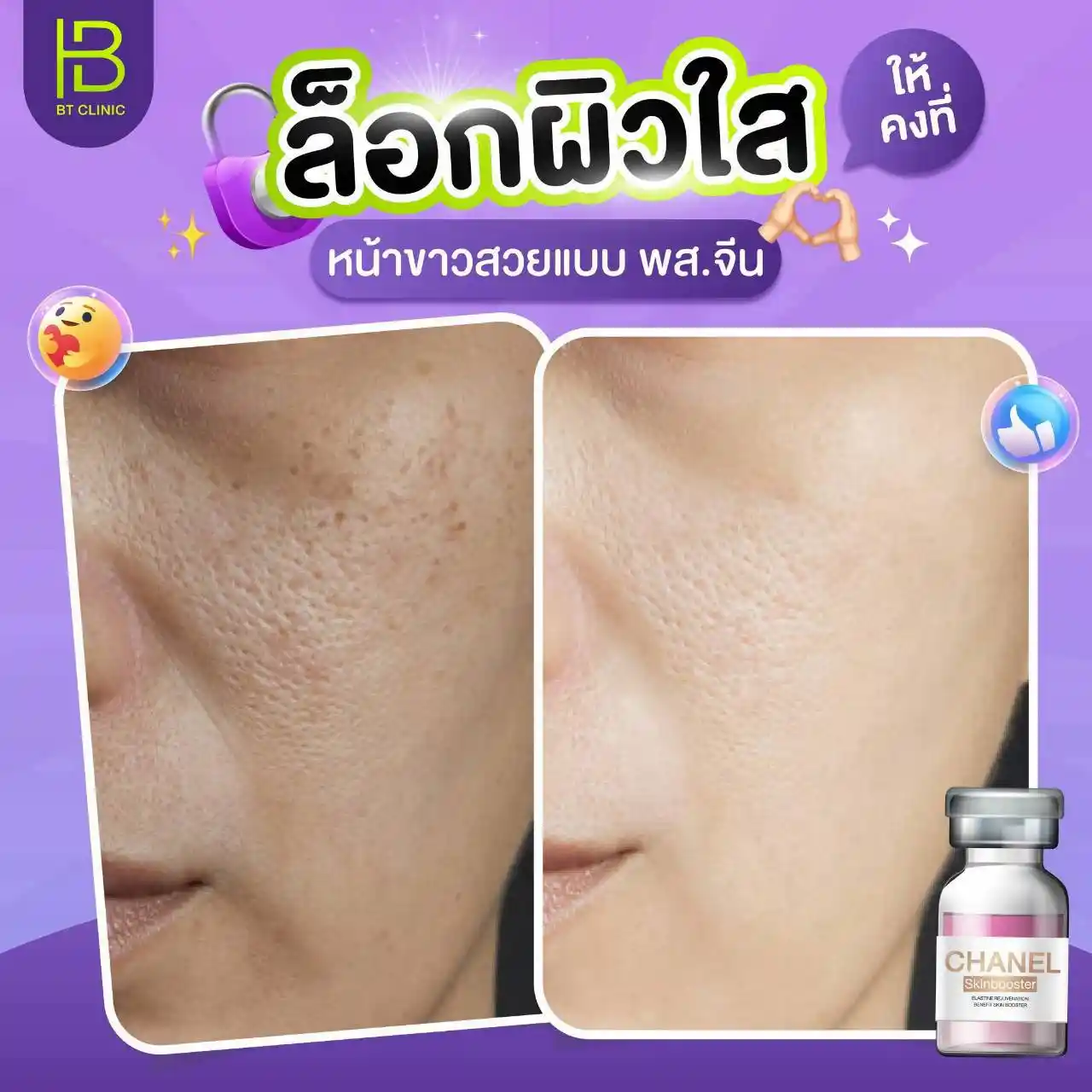 รูปรีวิว 075