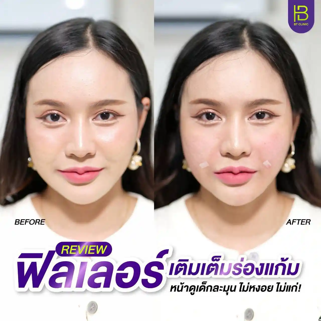 รูปรีวิว 079