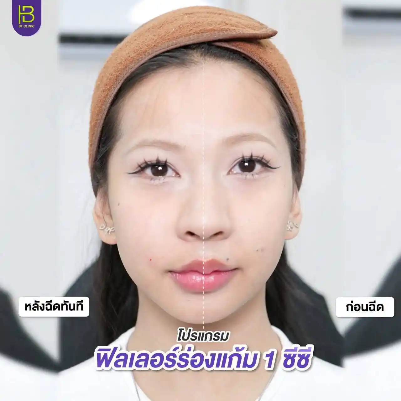 รูปรีวิว 082