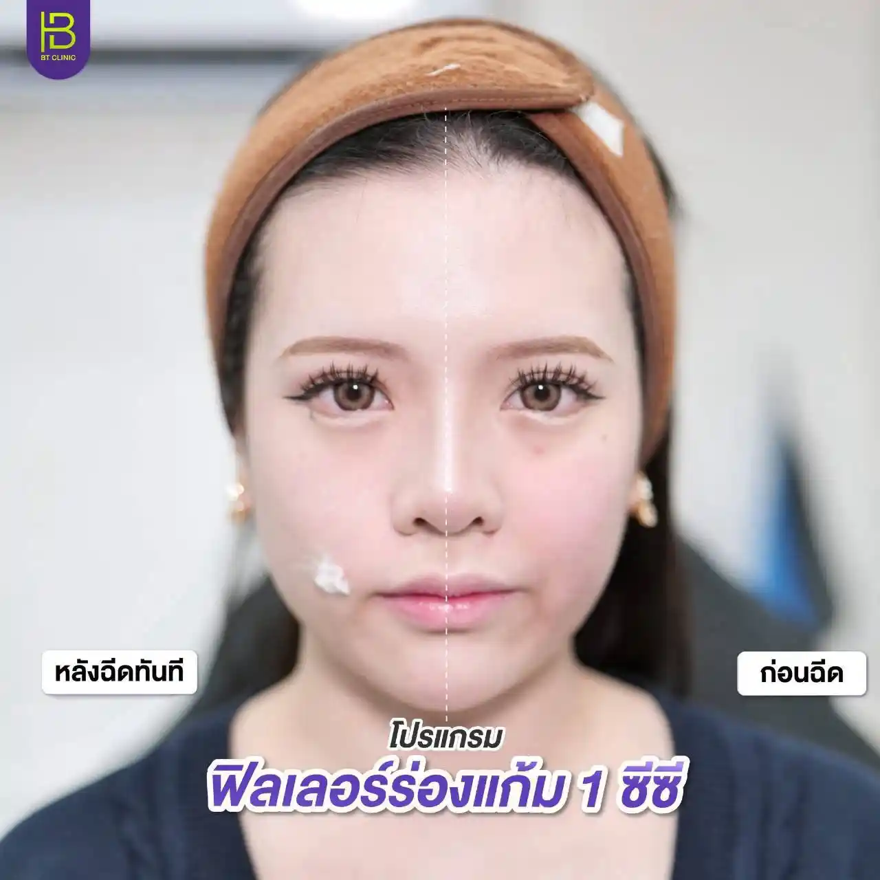 รูปรีวิว 084