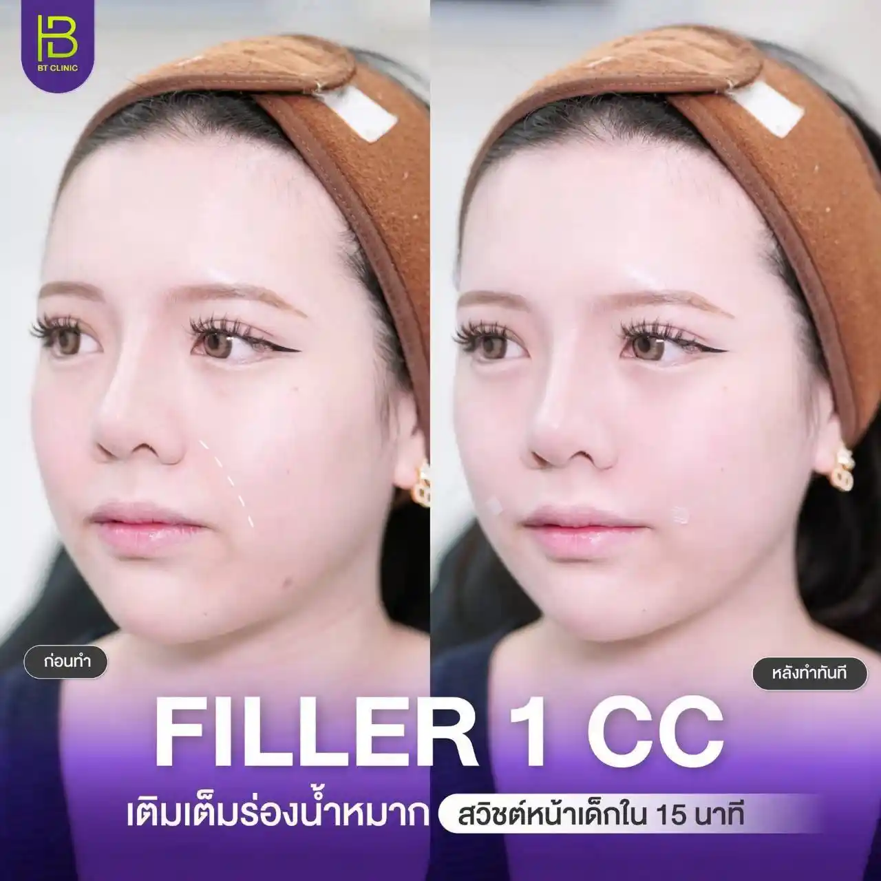 รูปรีวิว 086