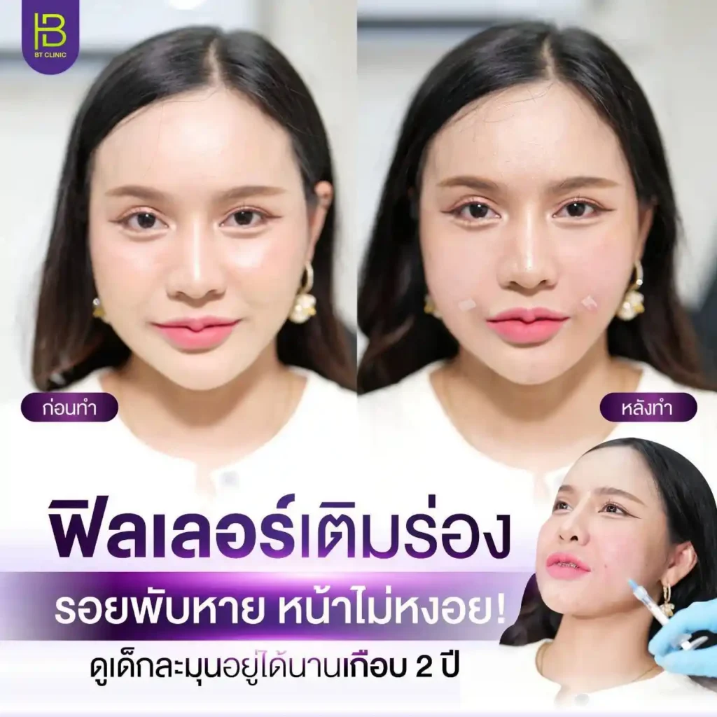 รูปรีวิว 087