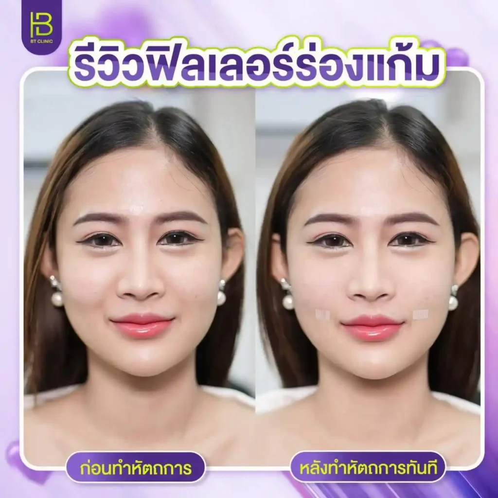 รูปรีวิว 088