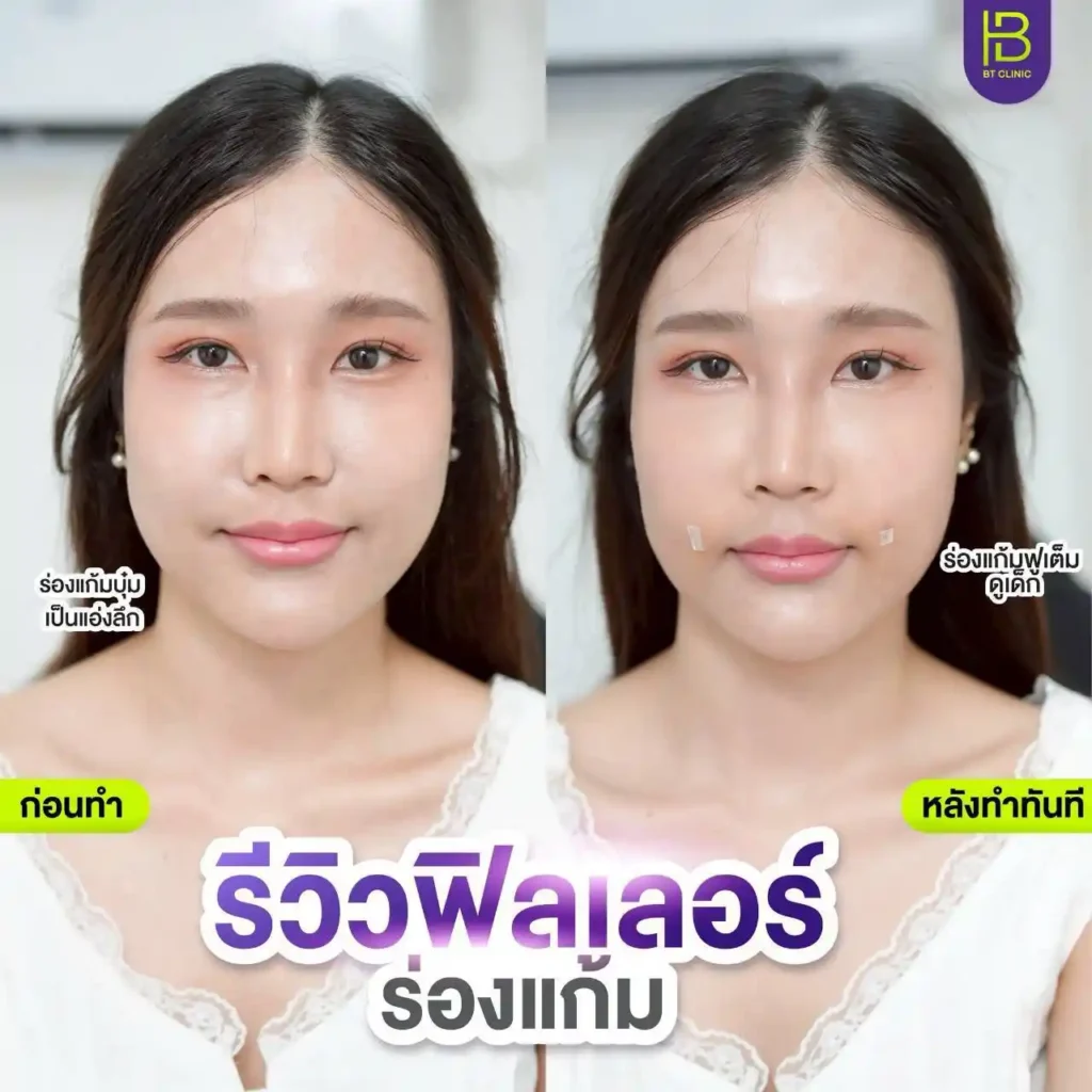รูปรีวิว 090