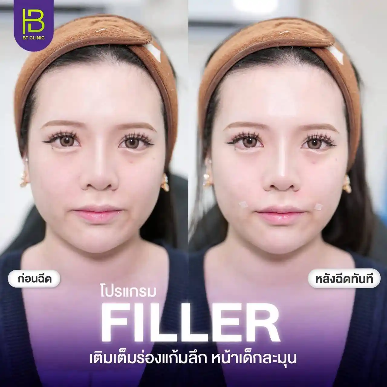 รูปรีวิว 092