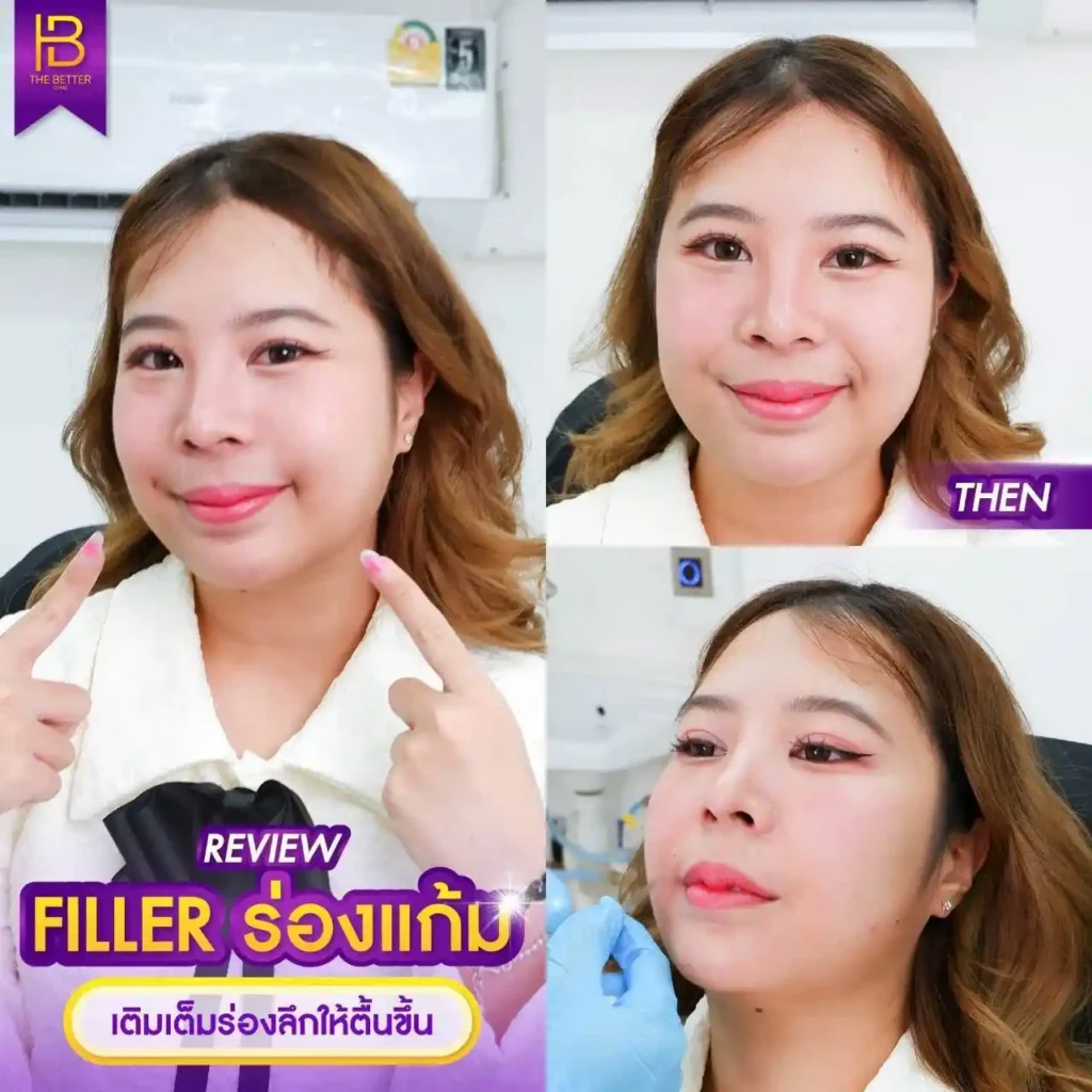 รูปรีวิว 093