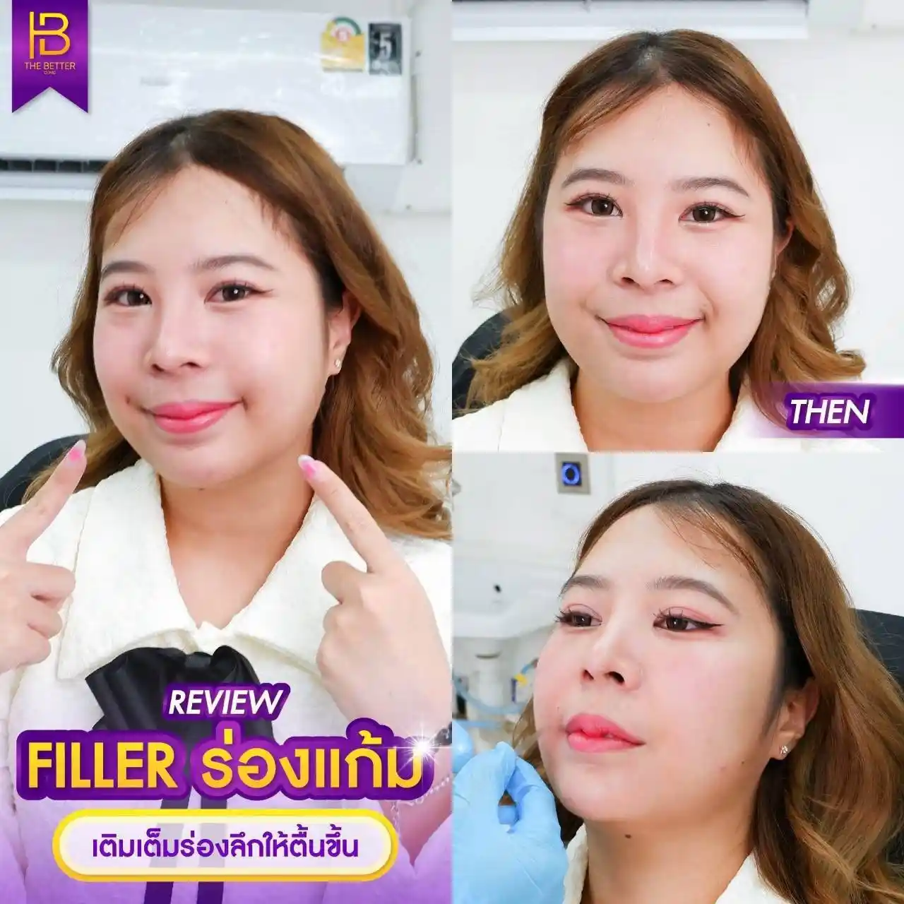 รูปรีวิว 093