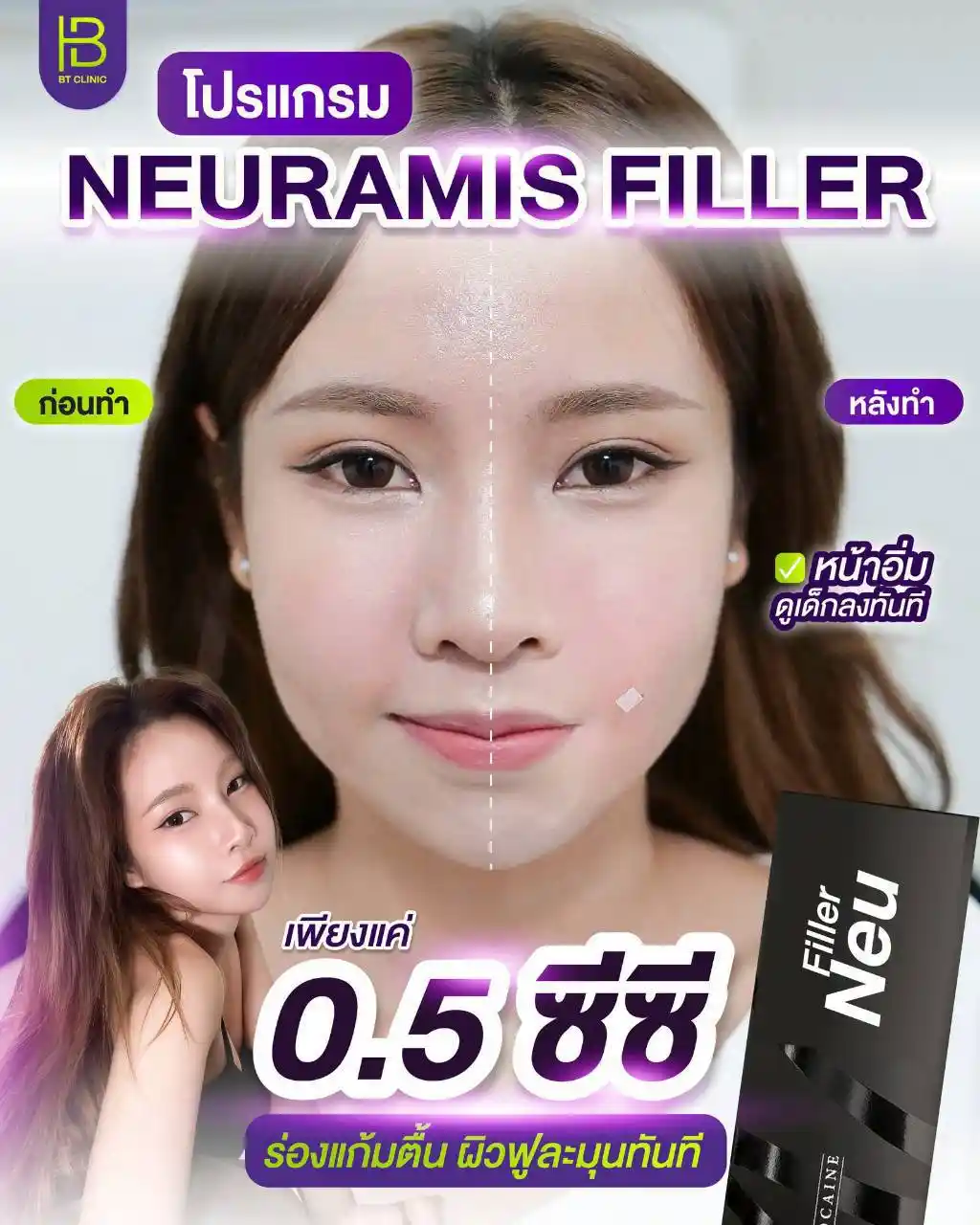 รูปรีวิว 101